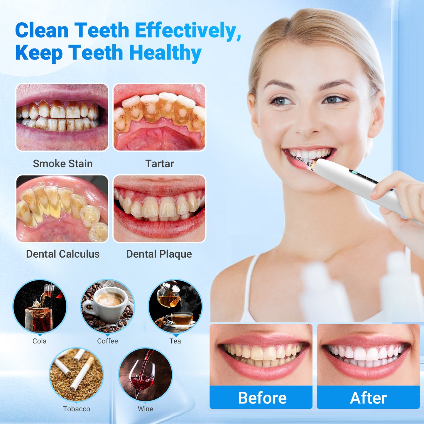 Household Intelligent Electric Visual Ultrasonic Teeth Cleaner